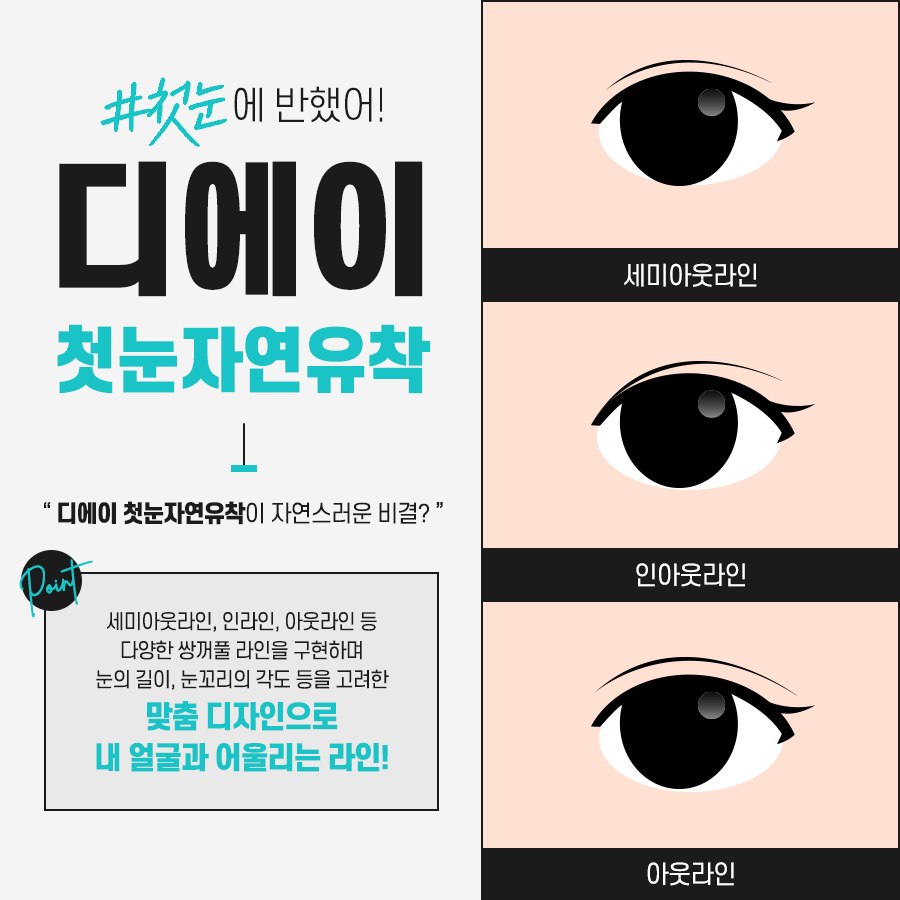 쌍꺼풀수술 후 풀림 현상을 예방하기 위해서는? 관련 이미지 5