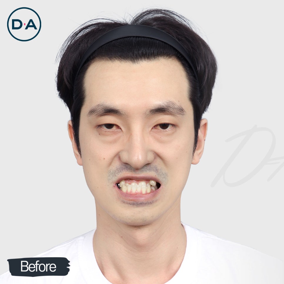 맥미남, 무엇이든물어보살 출연자는 무슨 성형 했을까? 관련 이미지 1
