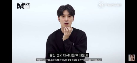 디에이성형외과 | 맥미남 시한폭탄내남자 개인인터뷰 근황 느낀점 관련 이미지 10
