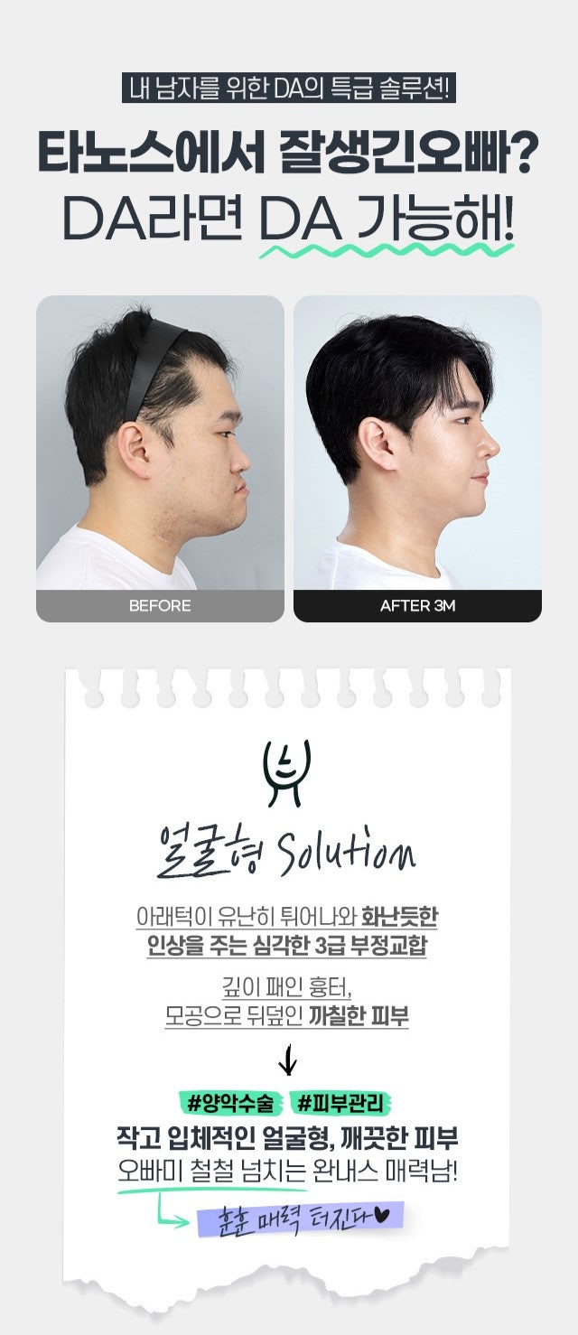 '맥미남' 새로운에피소드 야수내남자 솔루션 전후 모습 관련 이미지 4