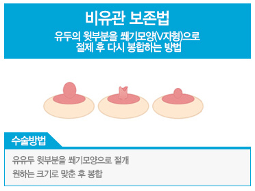 디에이 엄마를 부탁해 1. 가슴솔루션 관련 이미지 5