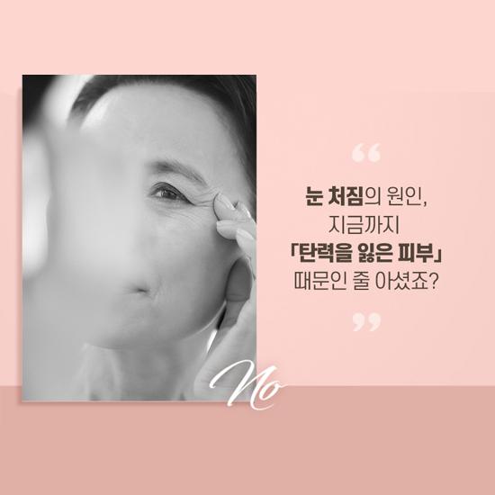 디에이성형외과 중년눈성형, 상안검수술 관련 이미지 3