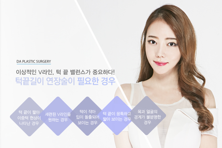 디에이성형외과 턱끝길이 연장술 관련 이미지 4