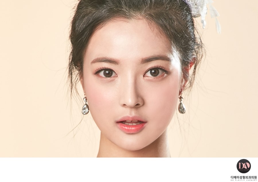 성공적인 눈성형, 관건은 눈형태에 따른 수술법 선택 관련 이미지 2