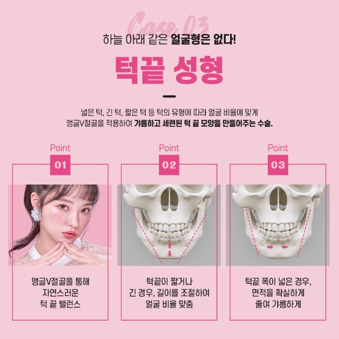 안면윤곽 수술 전 확인해야 하는 것은? 관련 이미지 8