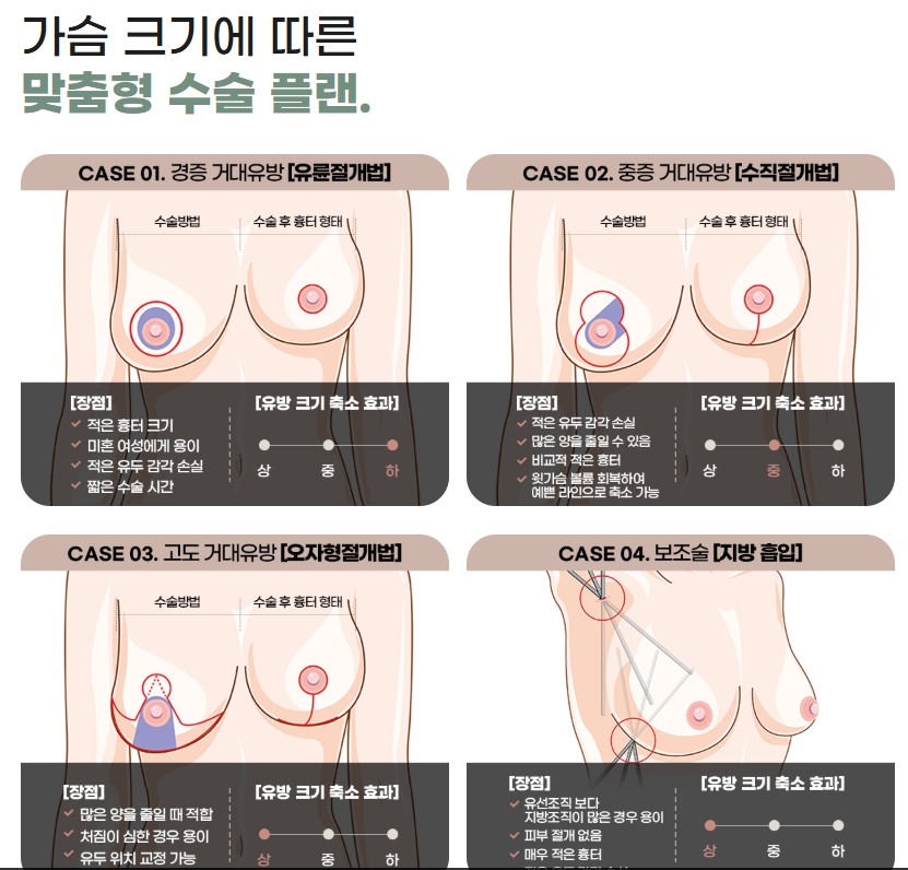 5 Things to Check Before Considering Breast Reduction Surgery Costs image 5