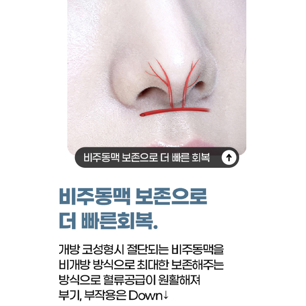 When You Want to Keep Your Image but Look Even Better: Closed Rhinoplasty Without Implants image 5