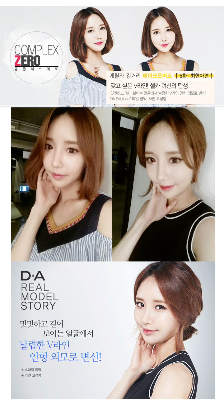 디에이성형외과 콤플렉스제로 5대 제로女 최현아편! 관련 이미지 9