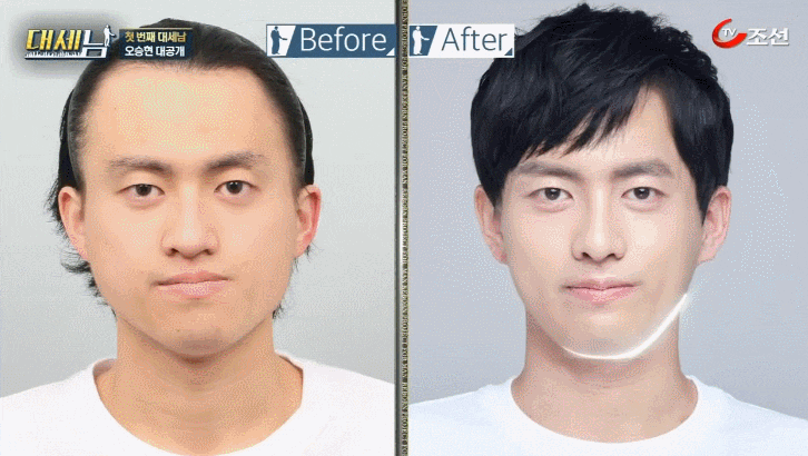 대세남 프랑켄슈타인 안면비대칭 오승현 관련 이미지 14