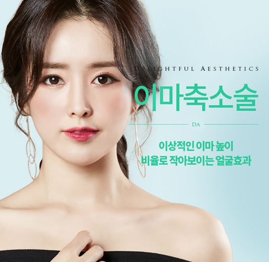 디에이성형외과 이마축소술, 작아보이는 얼굴 효과! 관련 이미지 2