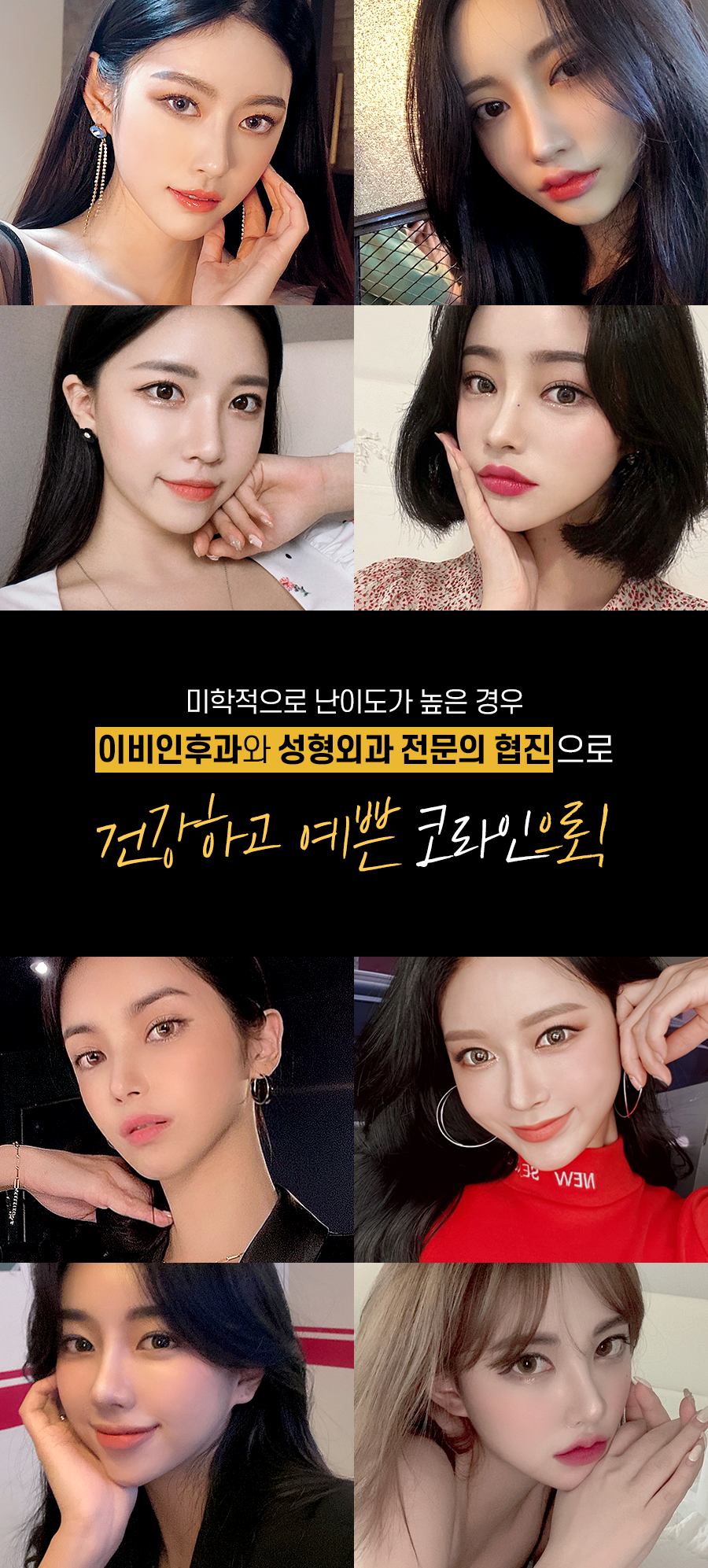 비염수술 코 내부의 구조적 문제를 해결해야 관련 이미지 10