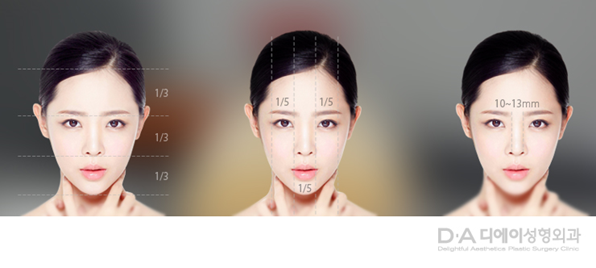 유형별 코성형의 특징과 방법 관련 이미지 2