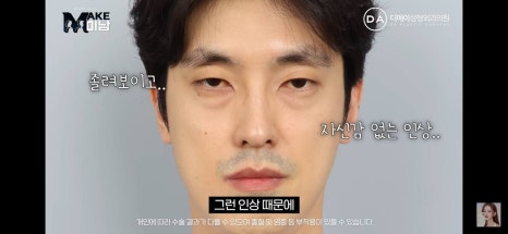 디에이성형외과 | 맥미남 시한폭탄내남자 개인인터뷰 근황 느낀점 관련 이미지 78