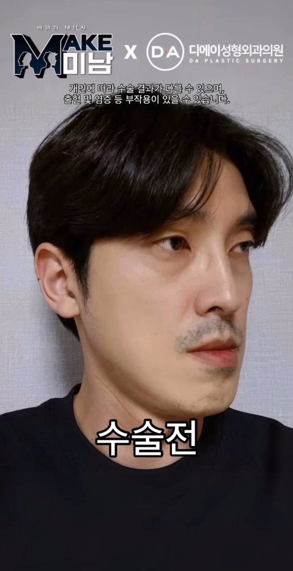 맥미남 MAKE미남 시한폭탄내남자 외모변천사 소개팅50번남 관련 이미지 1