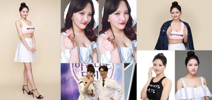 아름다운당신 시즌3 X 디에이성형외과가 함께 한 첫번째 주인공, 김단아 편 관련 이미지 5