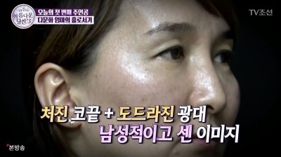 아름다운당신3 지나라씨와의 숨겨진 뒷이야기 공개 with 디에이성형외과 관련 이미지 6