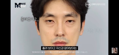 디에이성형외과 | 맥미남 시한폭탄내남자 개인인터뷰 근황 느낀점 관련 이미지 77