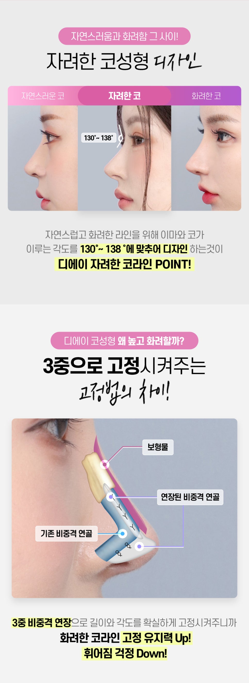 DA성형외과 | 코라인을 예쁘게 살리고 싶다면 관련 이미지 2