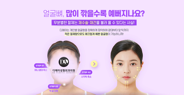 디에이성형외과, 윤곽3종으로 예쁨 UP 관련 이미지 12