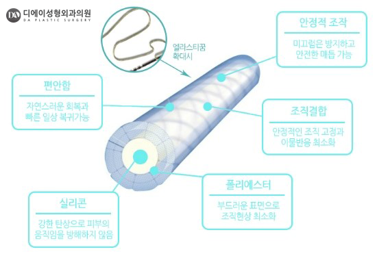 V라인 리프팅 종류 관련 이미지 8