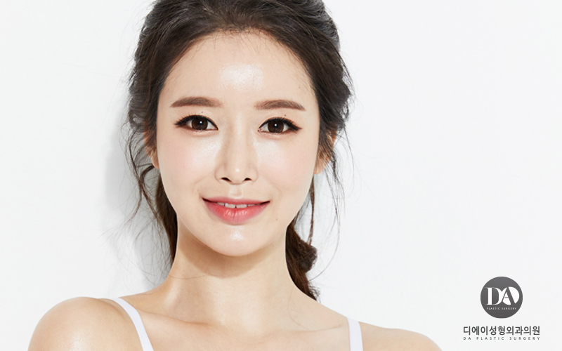 눈재수술 더이상의 실패는 NO! 관련 이미지 2