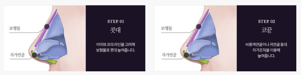 자연스러운 남자성형을 원한다면 관련 이미지 11