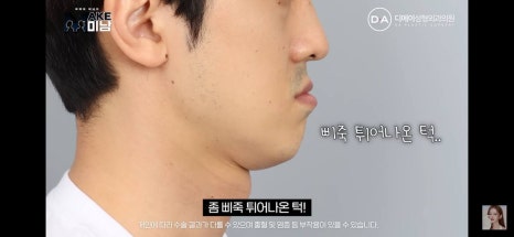 디에이성형외과 | 맥미남 시한폭탄내남자 개인인터뷰 근황 느낀점 관련 이미지 76