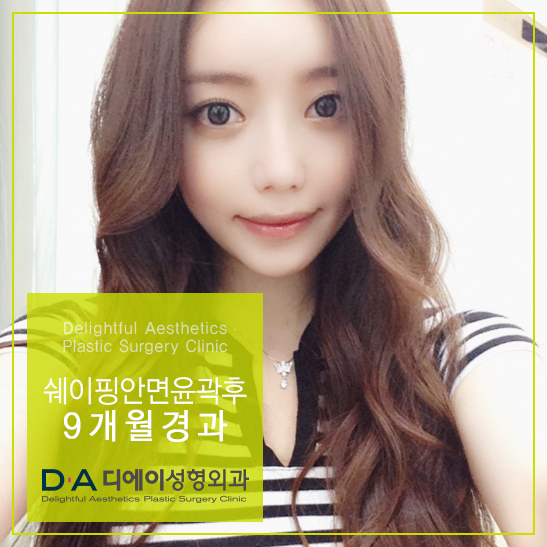 DA성형외과 쉐이핑안면윤곽수술로 매끈한 턱라인 완성! 관련 이미지 3