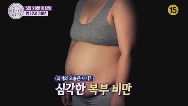⁠90간의 놀라운 변화, DA성형외과X아름다운당신3 감동의 마지막 주인공은⁠? 관련 이미지 8