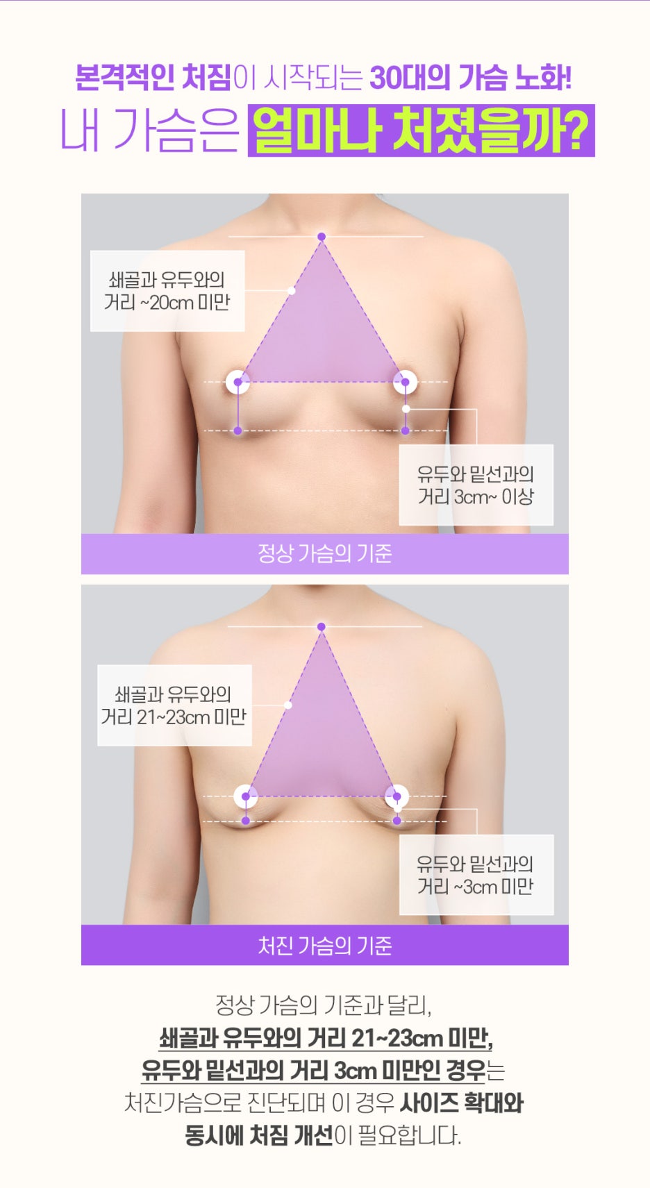 처진가슴리프팅 아름답고 자연스럽게 관련 이미지 5