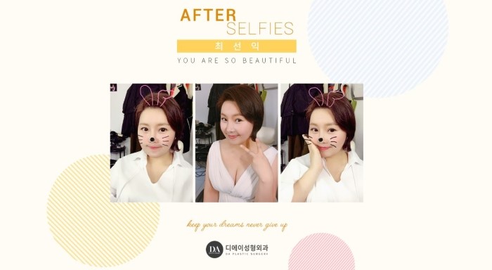 아름다운당신3 최선익 X DA성형외과 비하인드 컷 관련 이미지 15