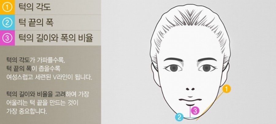 얼굴비율 바꾸는 턱끝길이연장 관련 이미지 3