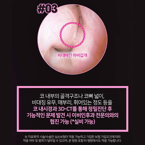 What Matters More Than a Nasal Ala Reduction Review image 10