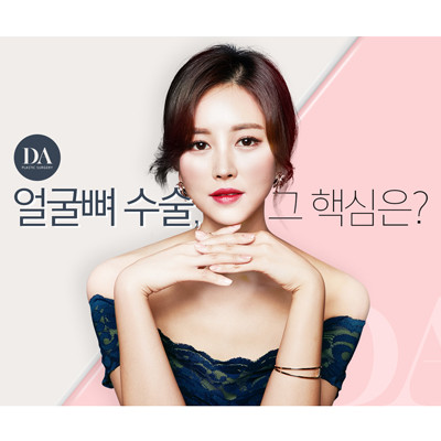 디에이성형외과 얼굴뼈 수술, 핵심은? 관련 이미지 12