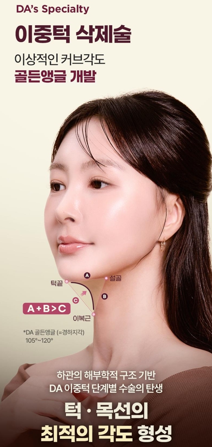 Double Chin Removal Surgery: Essential Information from Effects to Recovery Time image 11