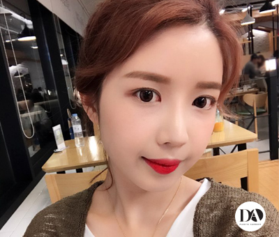 디에이성형외과 눈성형, 예쁘면DA야 관련 이미지 4