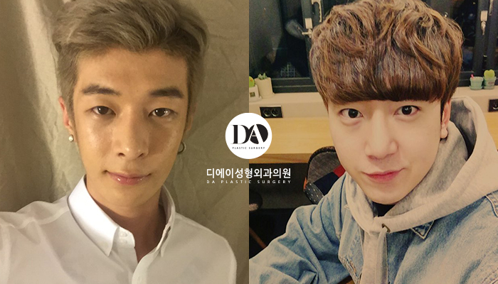 자연스러운 남자성형을 원한다면 관련 이미지 7