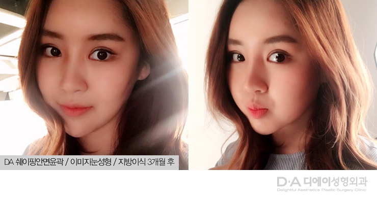 모델스토리 쉐이핑안면윤곽으로 청초한 분위기 여신 관련 이미지 3