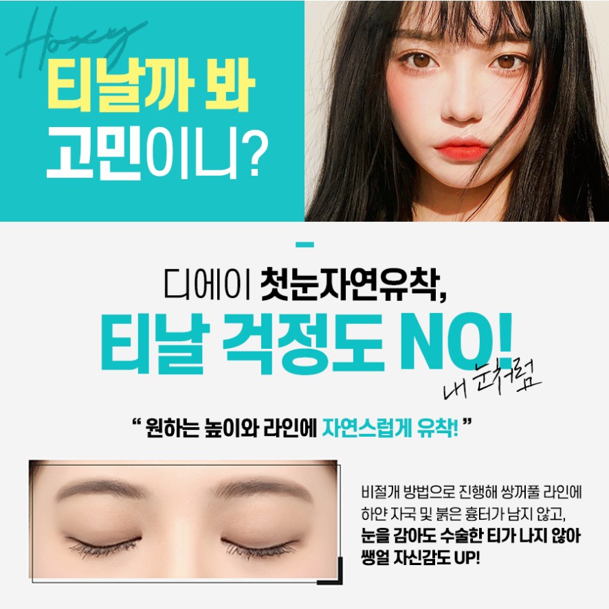 이미지에 맞게 라인 조절이 가능한 눈성형은? 관련 이미지 9