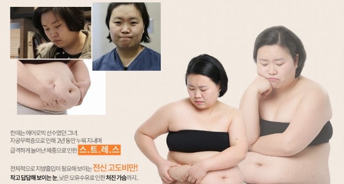 디에이성형외과 With 아름다운당신3 최선익 관련 이미지 3
