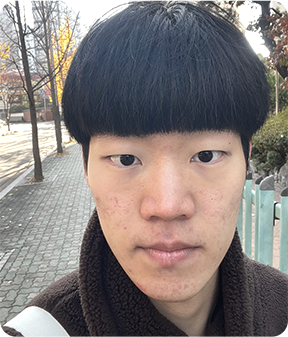 맥미남 | 소심남에서 훈남으로 - 디에이성형외과 방송출연 관련 이미지 3