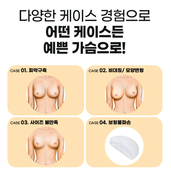 What Is the Best Plan for Breast Revision Surgery to Achieve the Highest Satisfaction? image 3