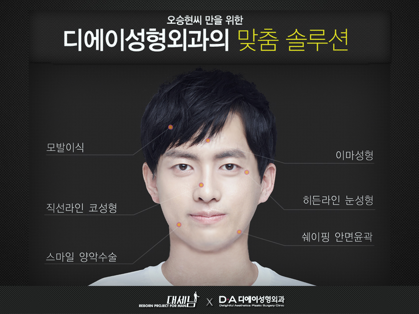대세남 프랑켄슈타인 안면비대칭 오승현 관련 이미지 13