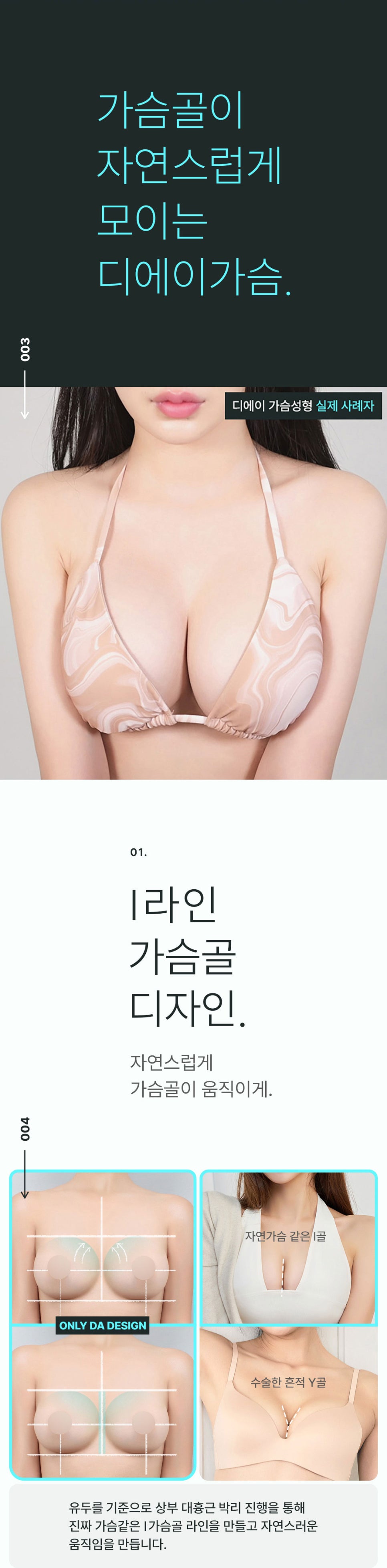 여리여리몸매 가슴성형 알아본다면 관련 이미지 3