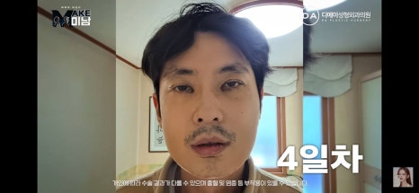 디에이성형외과 | 맥미남 시한폭탄내남자 개인인터뷰 근황 느낀점 관련 이미지 21