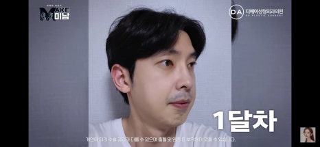 디에이성형외과 | 맥미남 시한폭탄내남자 개인인터뷰 근황 느낀점 관련 이미지 26