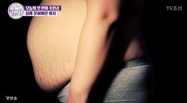 아름다운당신3 최선익 X DA성형외과 비하인드 컷 관련 이미지 4