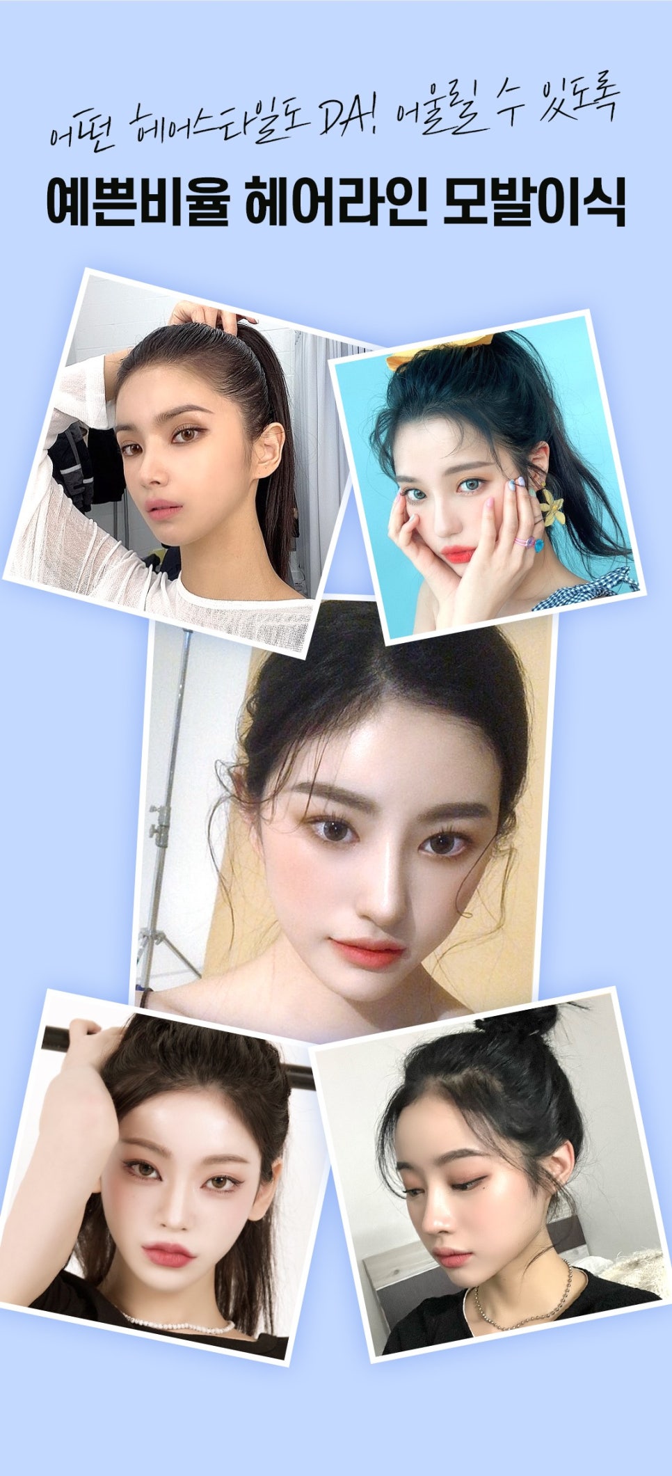 헤어라인 모발이식으로 인형외모갖기 관련 이미지 8