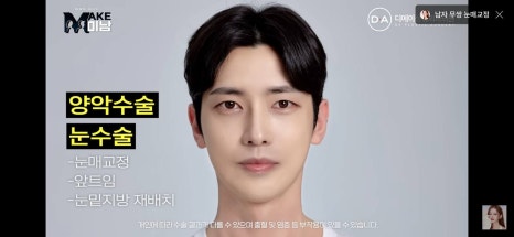 디에이성형외과 | 맥미남 시한폭탄내남자 개인인터뷰 근황 느낀점 관련 이미지 39