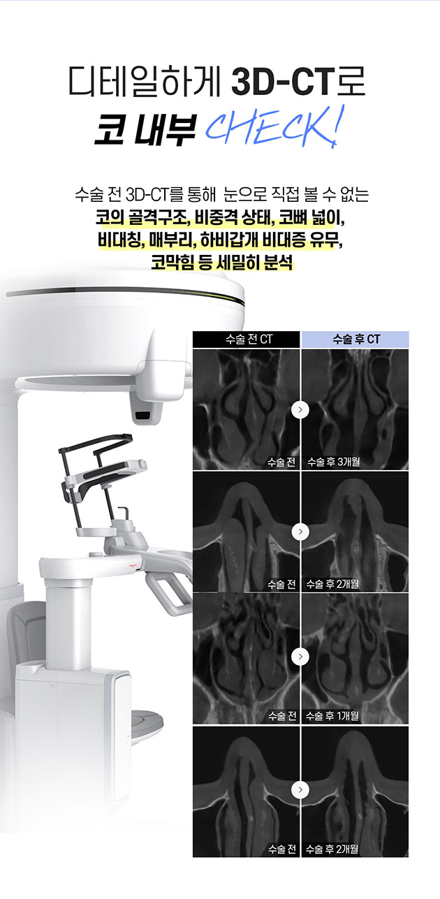 남자 기능코 수술 제대로 알고해야 관련 이미지 4